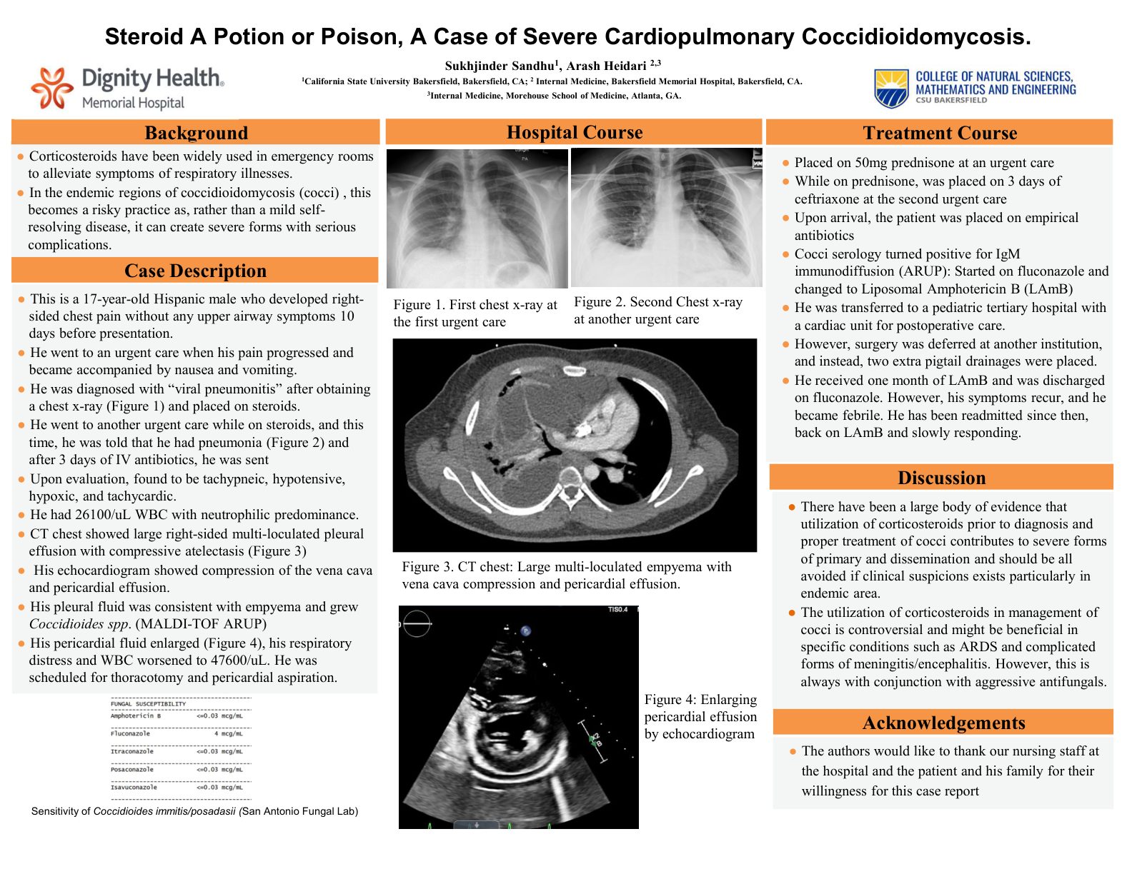 Steroid A Potion or Poison — Severe Cardiopulmonary Coccidioidomycosis