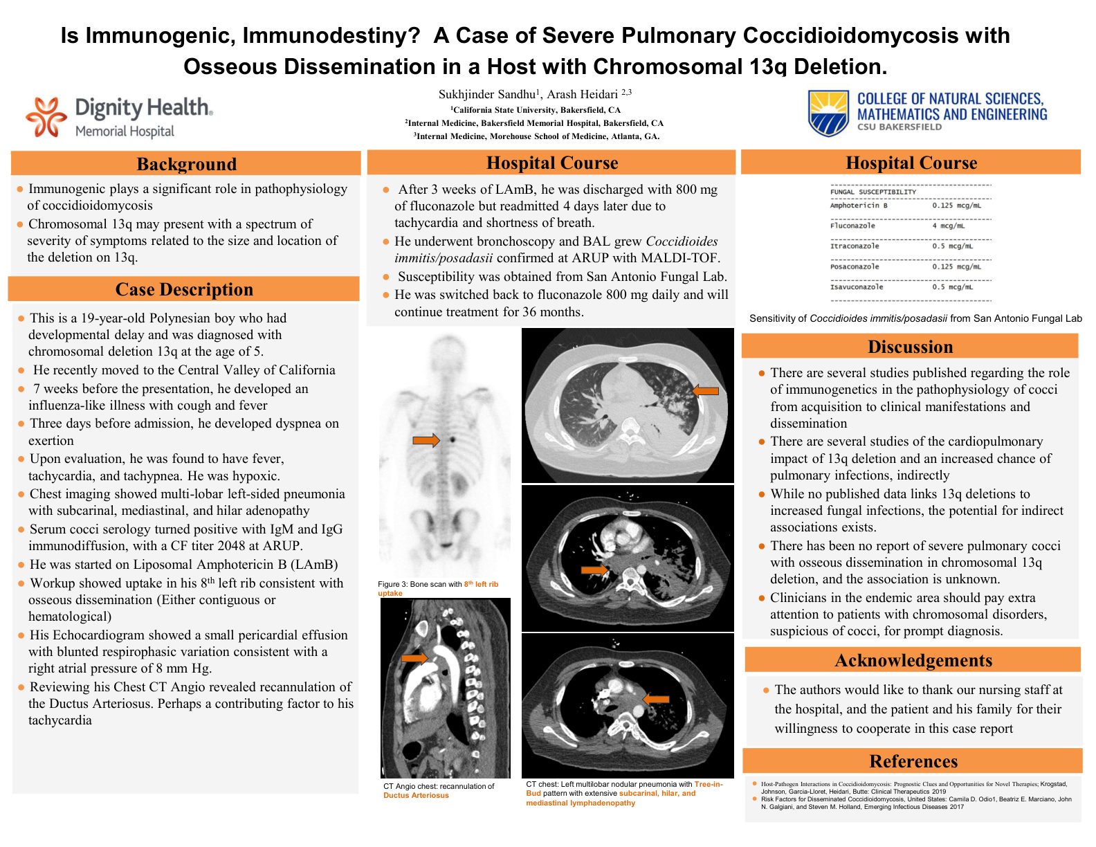 Severe Pulmonary Cocci with Chromosomal 13q Deletion